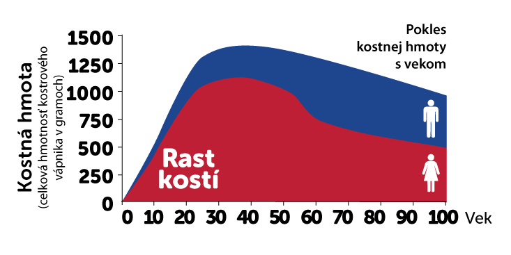 Infograf znázorňujúci okles kostnej hmoty s vekom